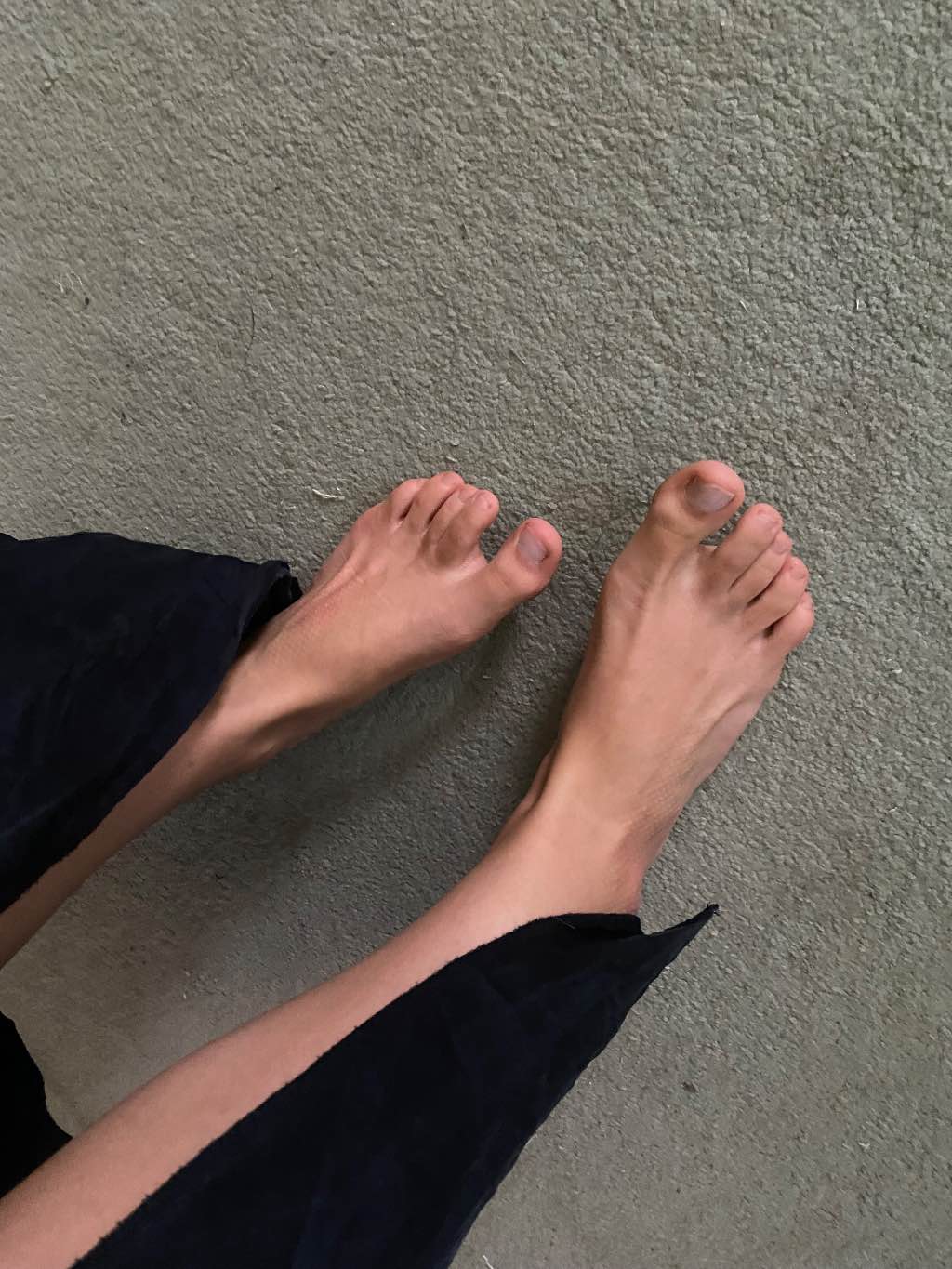 My unique feet